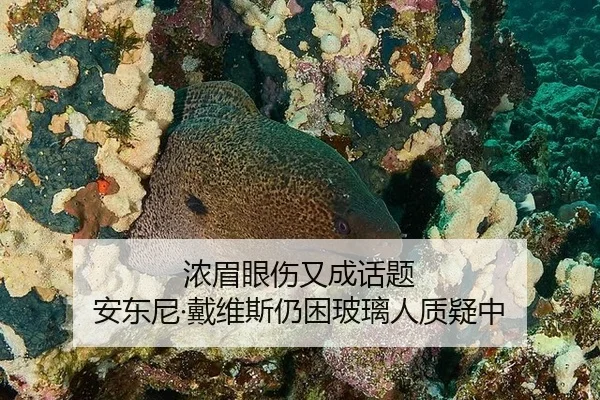 浓眉眼伤又成话题 安东尼·戴维斯仍困玻璃人质疑中